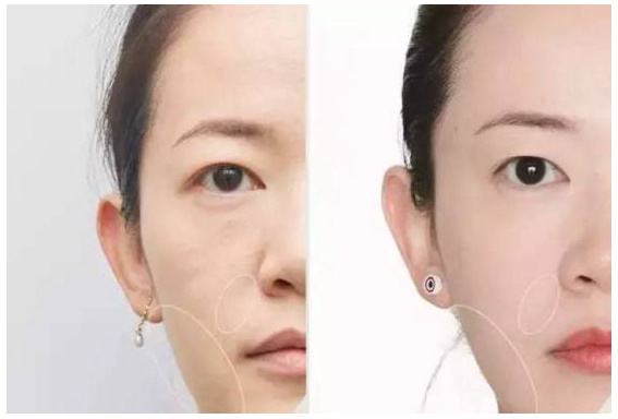 超级微拉美