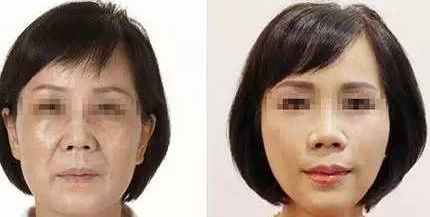 超级微拉美
