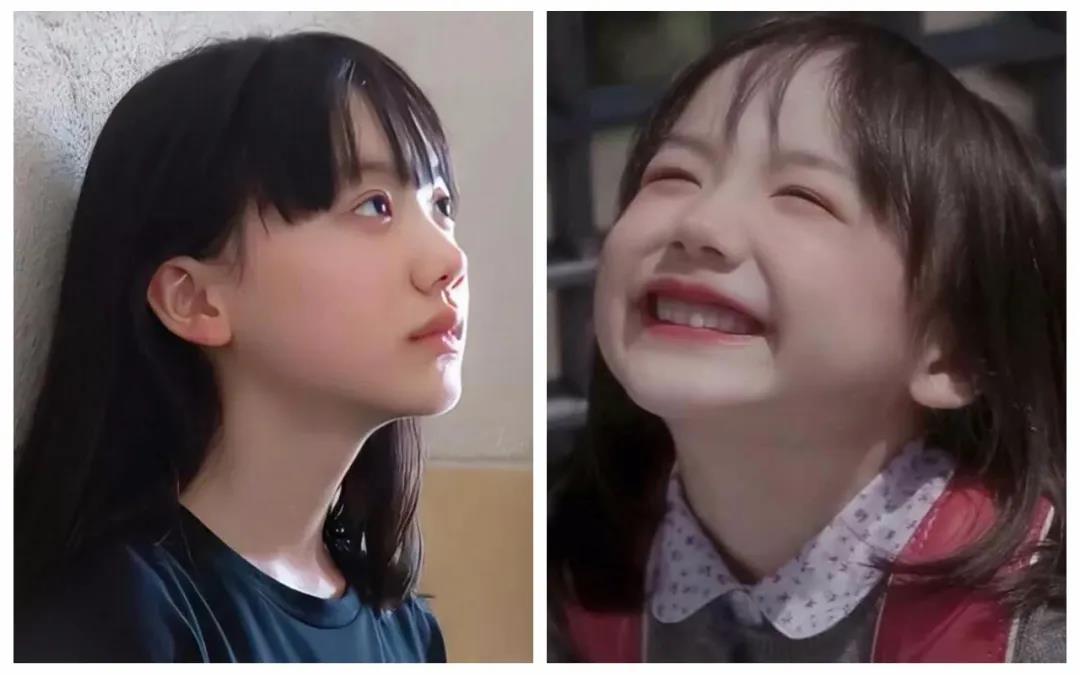 去眼袋手术