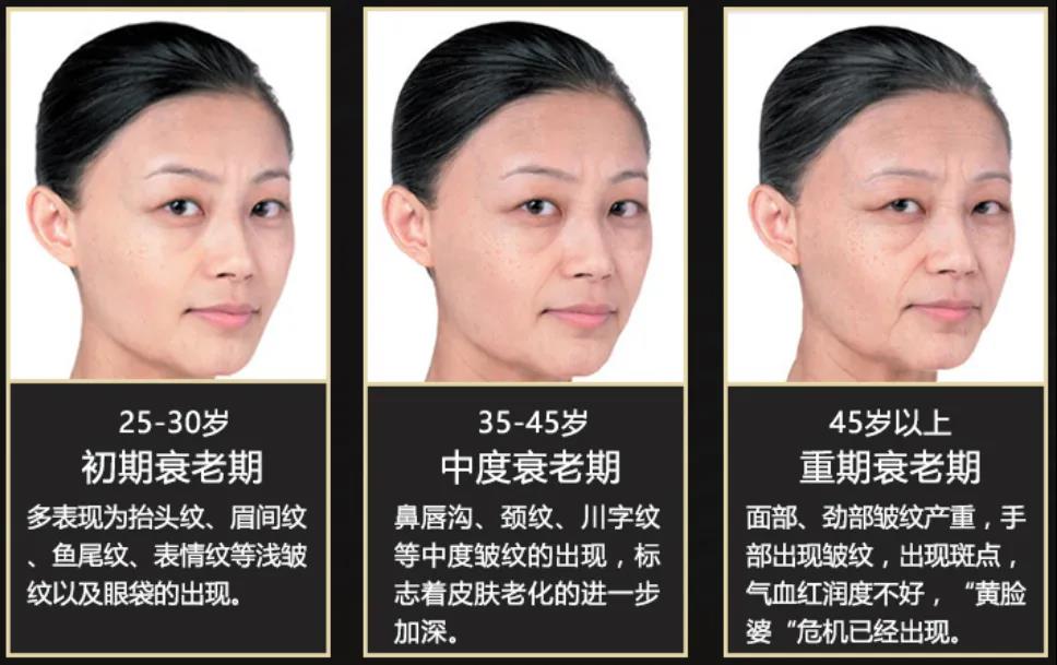 面部提升术