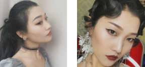 皮秒祛斑