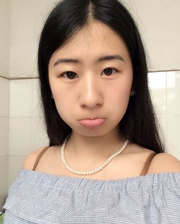 长效玻尿酸