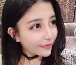 双眼皮手术