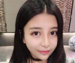 双眼皮手术
