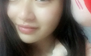 长效玻尿酸