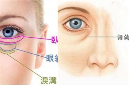去眼袋手术
