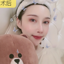 去眼袋手术