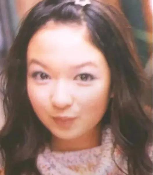 双眼皮手术