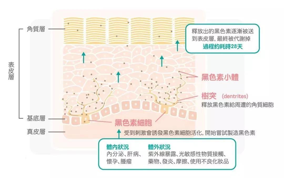 皮秒祛斑