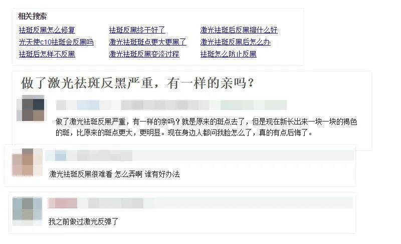 皮秒祛斑