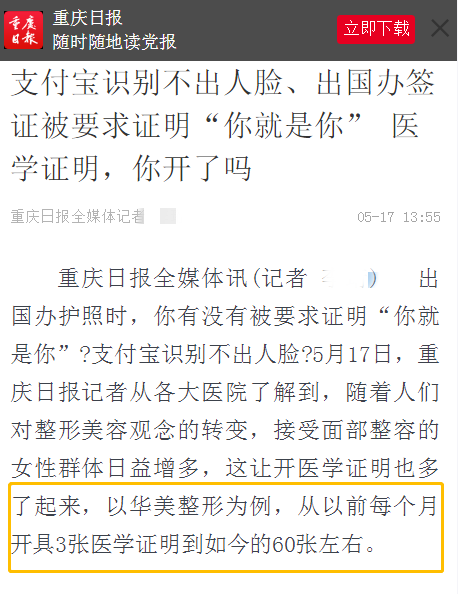 双眼皮手术