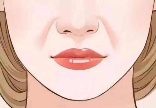 面部提升术