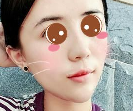 长效玻尿酸