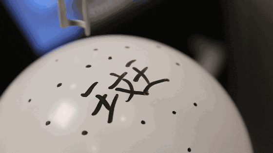 皮秒祛斑