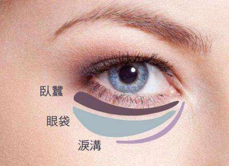 去眼袋手术