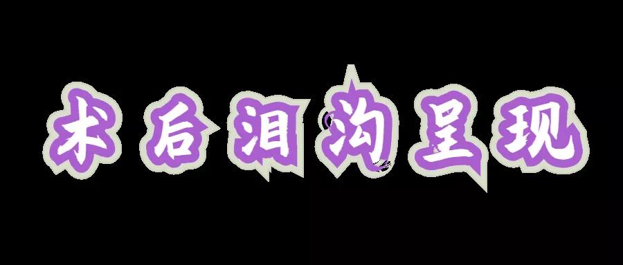 去眼袋手术