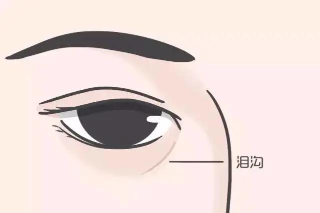 去眼袋手术