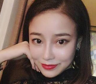 隆鼻手术