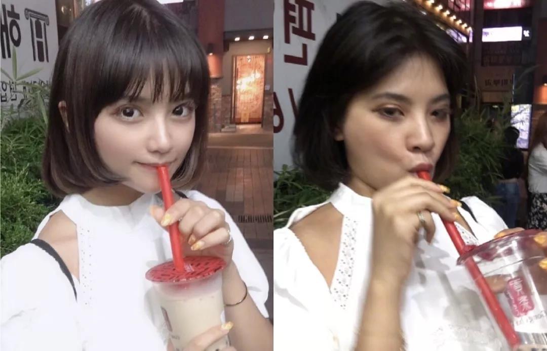 长效玻尿酸