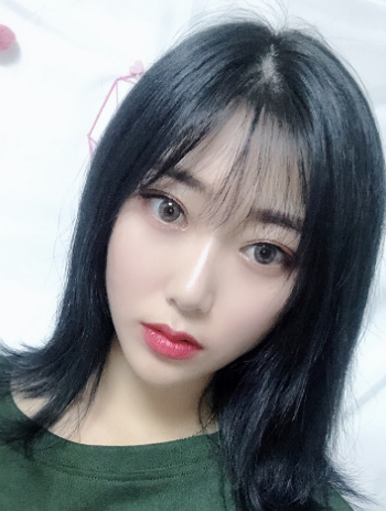 双眼皮手术