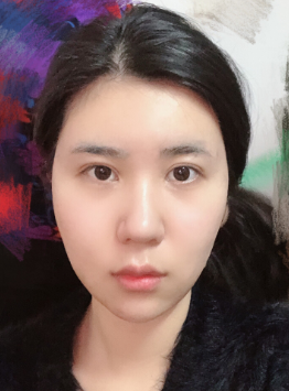 长效玻尿酸