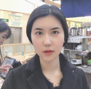 长效玻尿酸