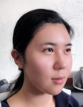 长效玻尿酸