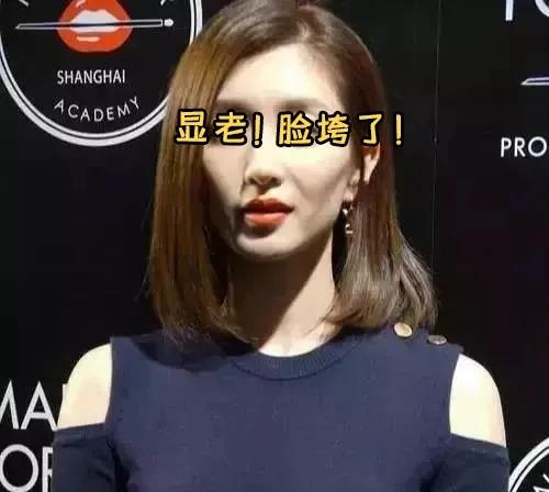 面部提升术