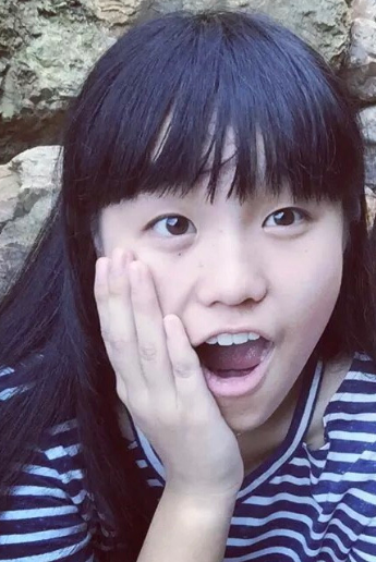 双眼皮手术