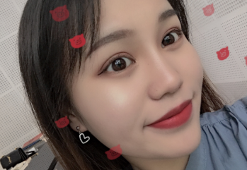 双眼皮手术