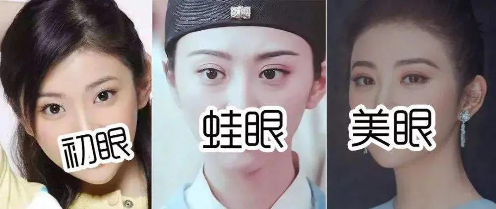 双眼皮手术