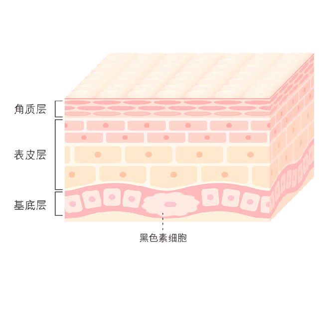 皮秒祛斑