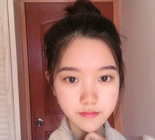 双眼皮手术