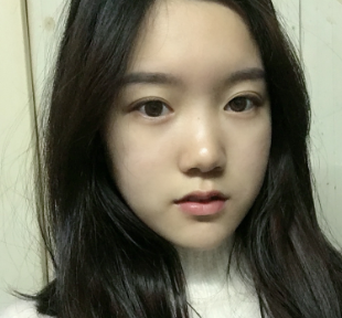 双眼皮手术