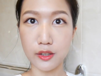 去眼袋手术