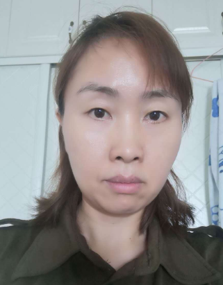 去眼袋手术