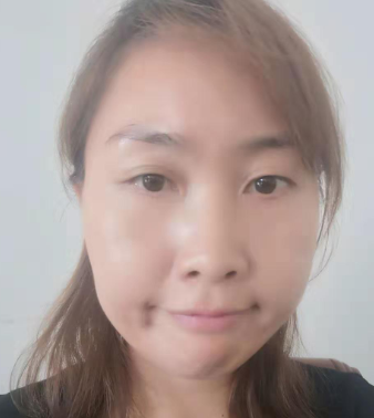 去眼袋手术