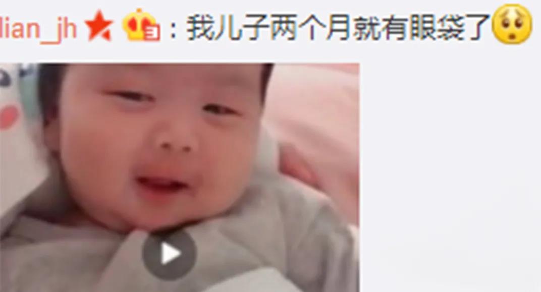 去眼袋手术