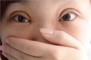 双眼皮手术