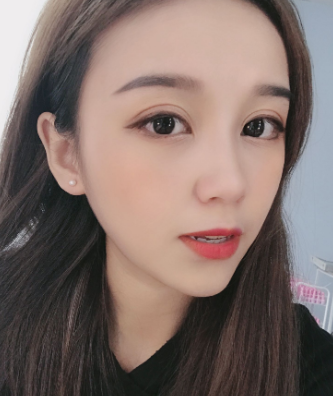 去眼袋手术