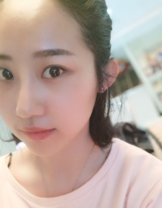 去眼袋手术