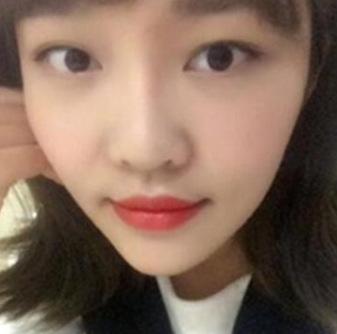 长效玻尿酸