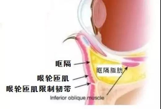 长效玻尿酸