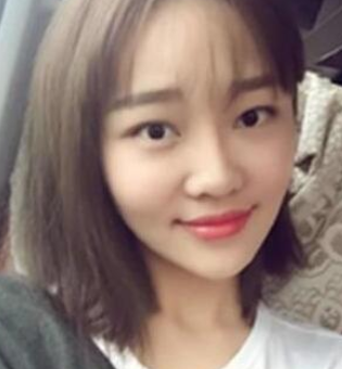 长效玻尿酸