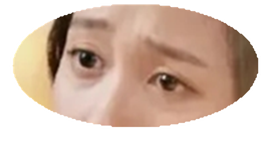 去眼袋手术