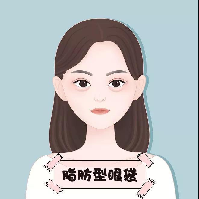 去眼袋手术