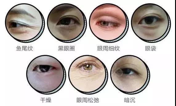 去眼袋手术