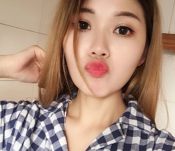 双眼皮手术