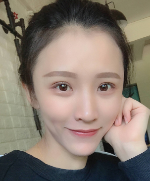 双眼皮手术
