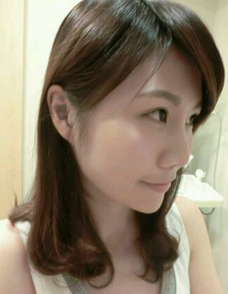 长效玻尿酸